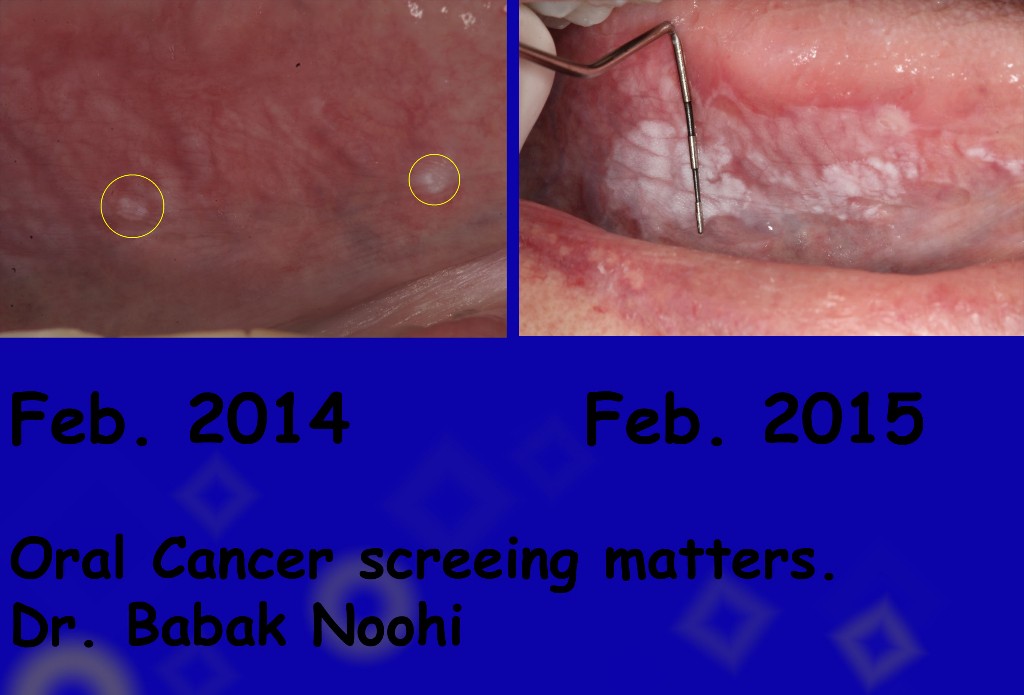 Oral-Cancer-Matters-web